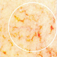 Cheek Capillaries Before